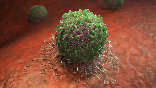 Cancer Resistance to Immunotherapy